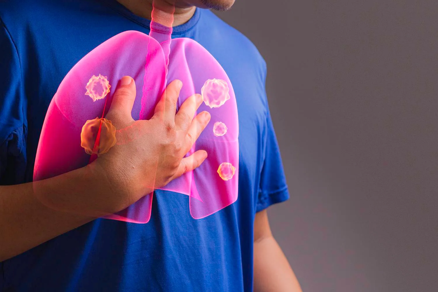 Dr. Alejandro Altamirano Jiménez: Terapias endovasculares para tromboembolia pulmonar en CDMX y Edo. Mex.